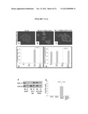 Lipase Inhibitors for the Treatment of Pancreatitis and Organ Failure diagram and image