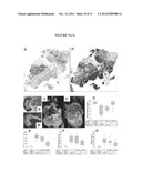 Lipase Inhibitors for the Treatment of Pancreatitis and Organ Failure diagram and image