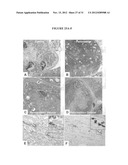 Lipase Inhibitors for the Treatment of Pancreatitis and Organ Failure diagram and image