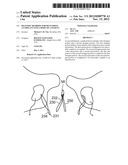 DELIVERY MEMBERS FOR DELIVERING AN IMPLANT INTO A BODY OF A PATIENT diagram and image