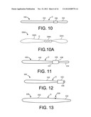 DELIVERY MEMBERS FOR DELIVERING AN IMPLANT INTO A BODY OF A PATIENT diagram and image