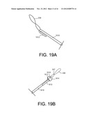 DELIVERY MEMBERS FOR DELIVERING AN IMPLANT INTO A BODY OF A PATIENT diagram and image