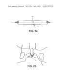 DELIVERY MEMBERS FOR DELIVERING AN IMPLANT INTO A BODY OF A PATIENT diagram and image