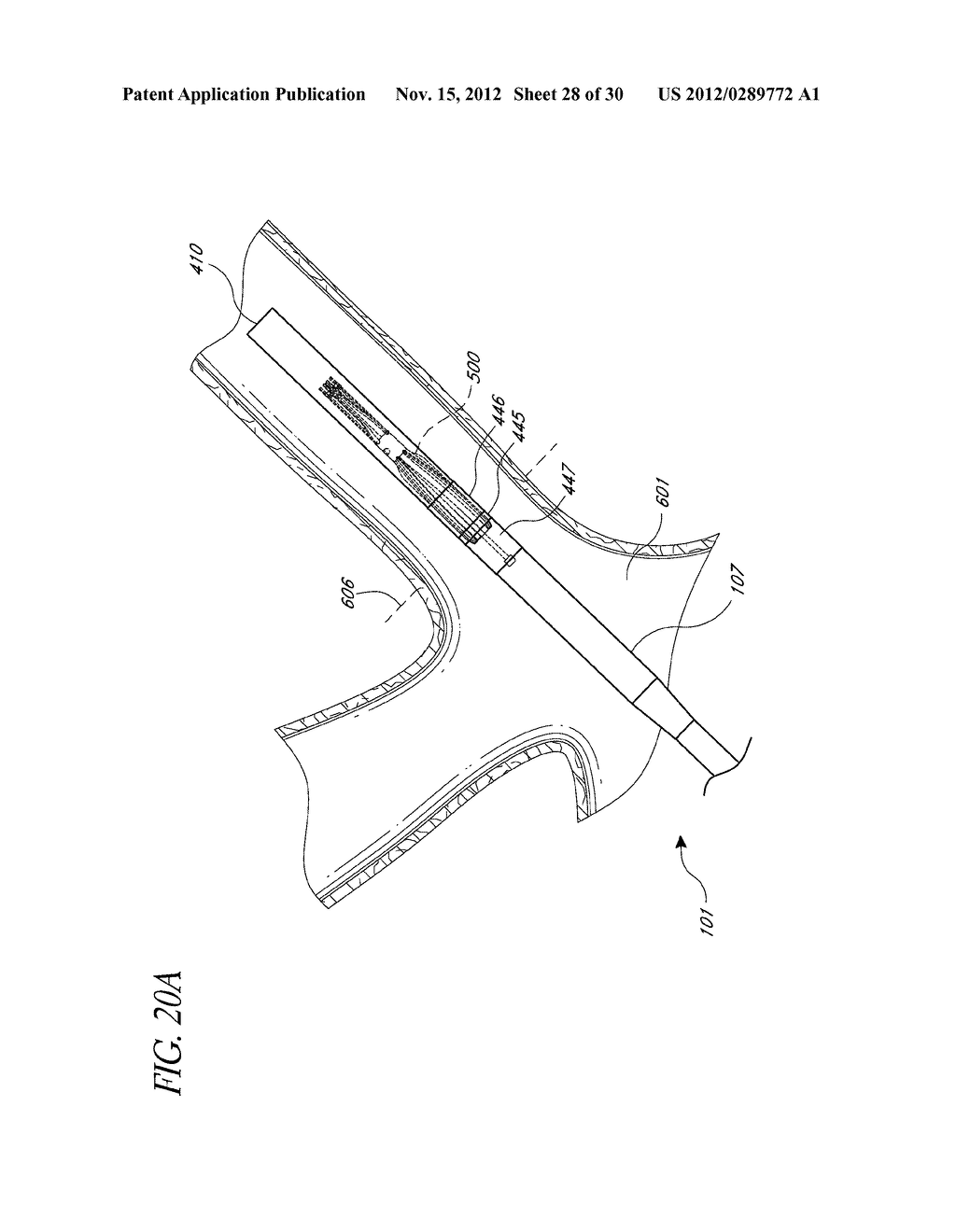 DEPLOYMENT CATHETER - diagram, schematic, and image 29