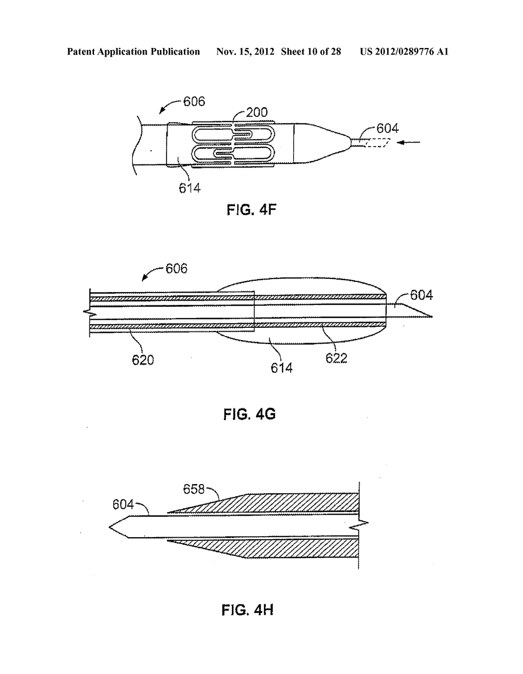 METHODS AND DEVICES FOR DIAGNOSING, MONITORING, OR TREATING MEDICAL     CONDITIONS THROUGH AN OPENING THROUGH AN AIRWAY WALL - diagram, schematic, and image 11