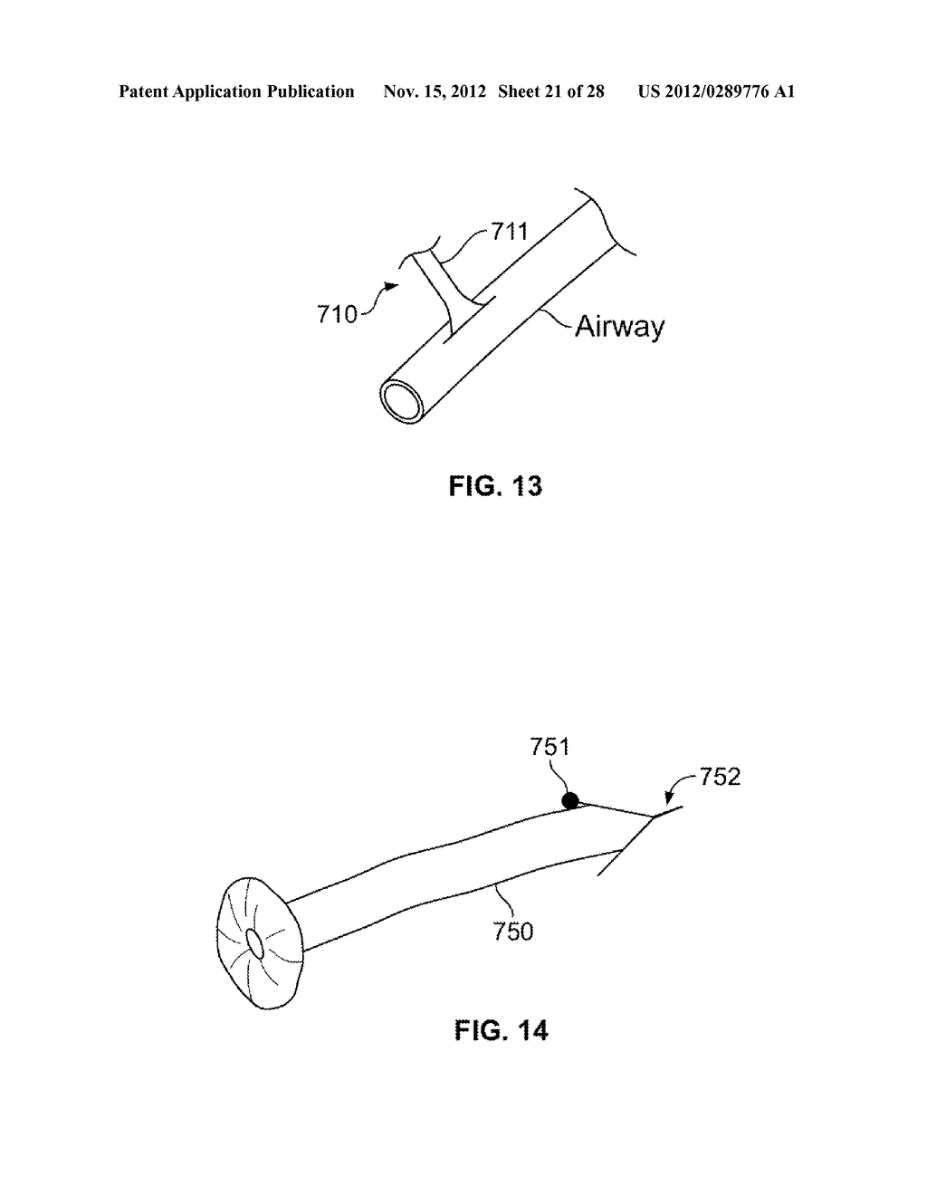 METHODS AND DEVICES FOR DIAGNOSING, MONITORING, OR TREATING MEDICAL     CONDITIONS THROUGH AN OPENING THROUGH AN AIRWAY WALL - diagram, schematic, and image 22