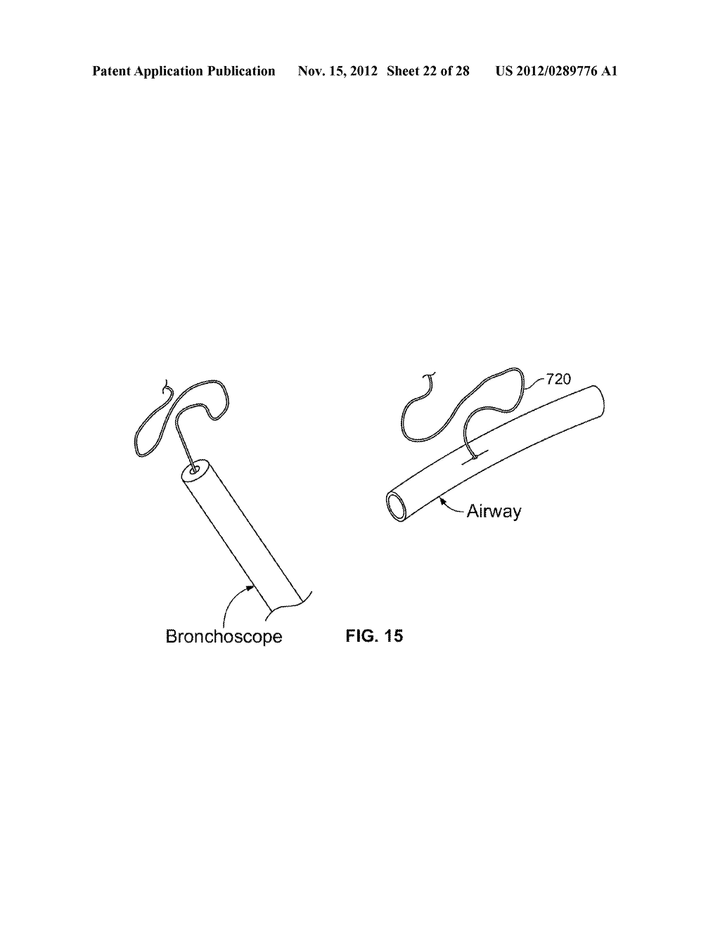 METHODS AND DEVICES FOR DIAGNOSING, MONITORING, OR TREATING MEDICAL     CONDITIONS THROUGH AN OPENING THROUGH AN AIRWAY WALL - diagram, schematic, and image 23