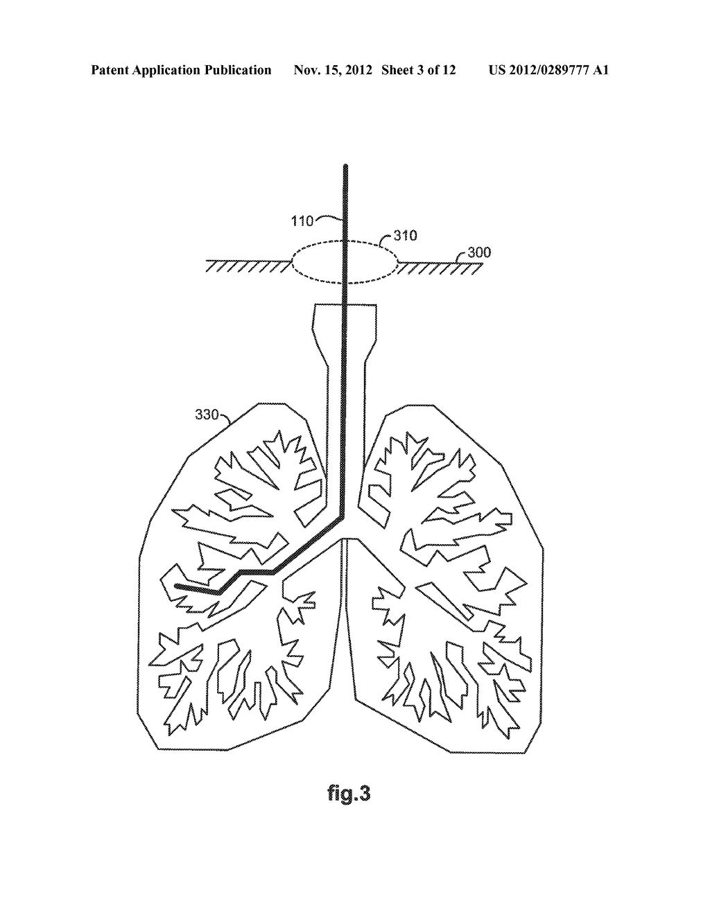 MEDICAL SYSTEM PROVIDING DYNAMIC REGISTRATION OF A MODEL OF AN ANATOMICAL     STRUCTURE FOR IMAGE-GUIDED SURGERY - diagram, schematic, and image 04