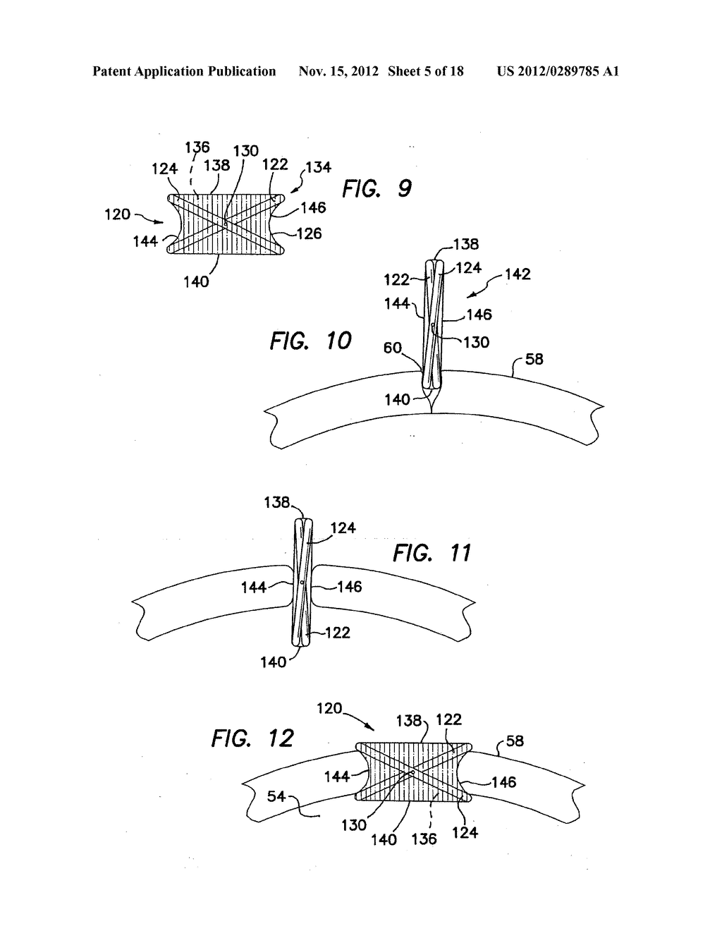 WOUND RETRACTOR - diagram, schematic, and image 06