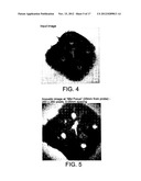 Acoustic Imaging Probe Incorporating Photoacoustic Excitation diagram and image