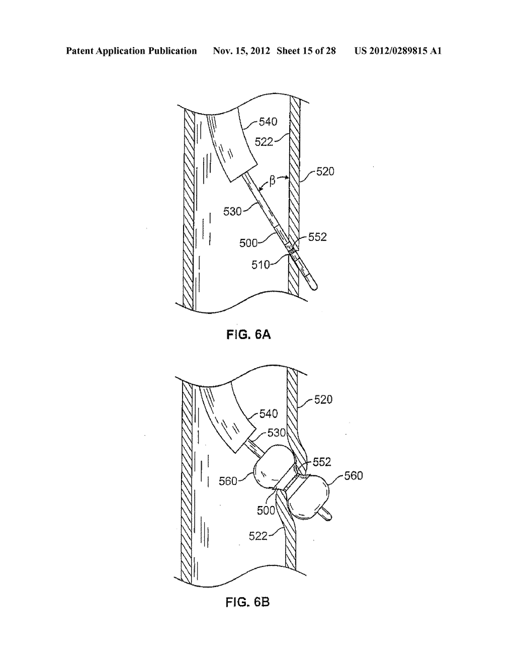 METHODS AND DEVICES FOR DIAGNOSING, MONITORING, OR TREATING MEDICAL     CONDITIONS THROUGH AN OPENING THROUGH AN AIRWAY WALL - diagram, schematic, and image 16