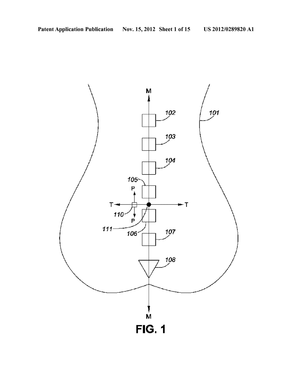 Apparatus And Method For Imaging A Medical Instrument - diagram, schematic, and image 02