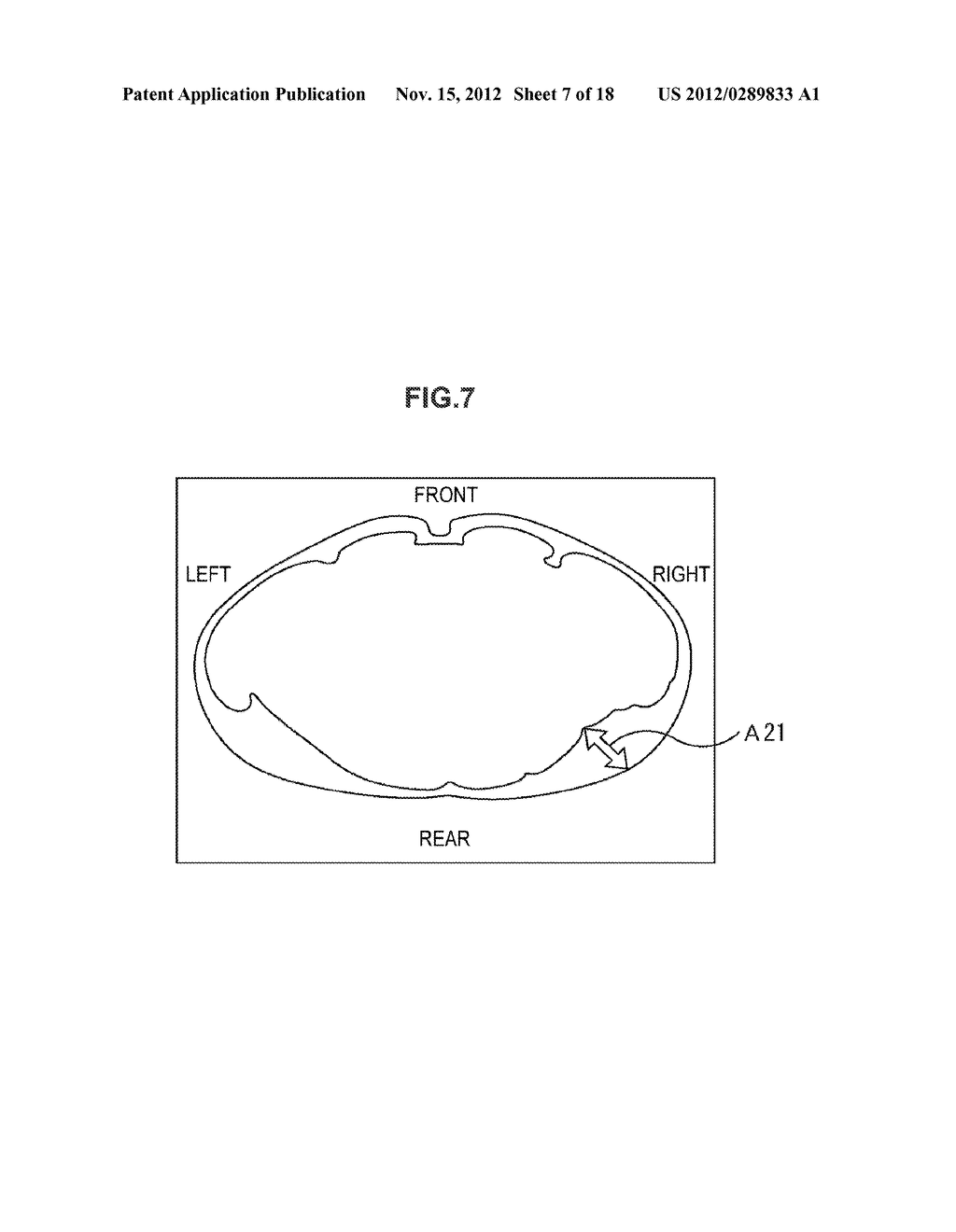 IMAGE PROCESSING DEVICE, IMAGE PROCESSING METHOD, PROGRAM, RECORDING     MEDIUM, IMAGE PROCESSING SYSTEM, AND PROBE - diagram, schematic, and image 08