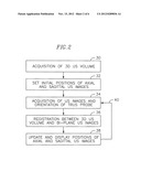 AUTOMATIC REAL-TIME DISPLAY SYSTEM FOR THE ORIENTATION AND LOCATION OF AN     ULTRASOUND TOMOGRAM IN A THREE-DIMENSIONAL ORGAN MODEL diagram and image