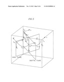 AUTOMATIC REAL-TIME DISPLAY SYSTEM FOR THE ORIENTATION AND LOCATION OF AN     ULTRASOUND TOMOGRAM IN A THREE-DIMENSIONAL ORGAN MODEL diagram and image