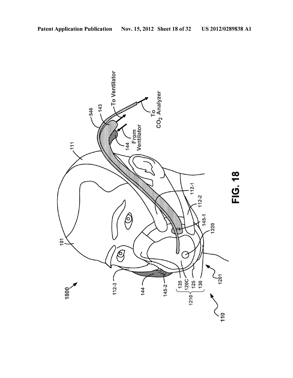 CARBON-DIOXIDE SAMPLING SYSTEM FOR ACCURATELY MONITORING CARBON DIOXIDE IN     EXHALED BREATH - diagram, schematic, and image 19