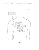 TECHNIQUES FOR DETERMINING MORPHOLOGICAL STABILITY OF CARDIAC CYCLES diagram and image