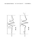 TECHNIQUES FOR DETERMINING CARDIAC CYCLE MORPHOLOGY diagram and image