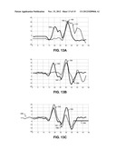 TECHNIQUES FOR DETERMINING CARDIAC CYCLE MORPHOLOGY diagram and image