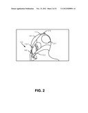 CARBON-DIOXIDE SAMPLING DEVICE FOR NONINVASIVELY MEASURING CARBON DIOXIDE     IN EXHALED BREATH diagram and image