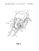 CARBON-DIOXIDE SAMPLING DEVICE FOR NONINVASIVELY MEASURING CARBON DIOXIDE     IN EXHALED BREATH diagram and image