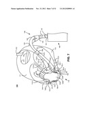 CARBON-DIOXIDE SAMPLING DEVICE FOR NONINVASIVELY MEASURING CARBON DIOXIDE     IN EXHALED BREATH diagram and image