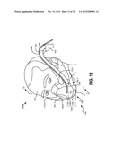 CARBON-DIOXIDE SAMPLING DEVICE FOR NONINVASIVELY MEASURING CARBON DIOXIDE     IN EXHALED BREATH diagram and image