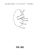 CARBON-DIOXIDE SAMPLING DEVICE FOR NONINVASIVELY MEASURING CARBON DIOXIDE     IN EXHALED BREATH diagram and image