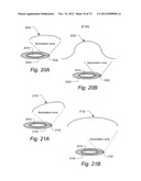 METHOD AND APPARATUS FOR HYSTEROSCOPY AND ENDOMETRIAL BIOPSY diagram and image