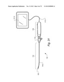 METHOD AND APPARATUS FOR HYSTEROSCOPY AND ENDOMETRIAL BIOPSY diagram and image