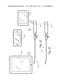 METHOD AND APPARATUS FOR HYSTEROSCOPY AND ENDOMETRIAL BIOPSY diagram and image