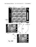 METHOD AND APPARATUS FOR HYSTEROSCOPY AND ENDOMETRIAL BIOPSY diagram and image