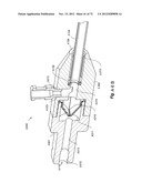 METHOD AND APPARATUS FOR HYSTEROSCOPY AND ENDOMETRIAL BIOPSY diagram and image