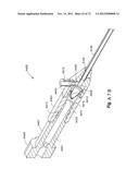 METHOD AND APPARATUS FOR HYSTEROSCOPY AND ENDOMETRIAL BIOPSY diagram and image