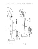 METHOD AND APPARATUS FOR HYSTEROSCOPY AND ENDOMETRIAL BIOPSY diagram and image