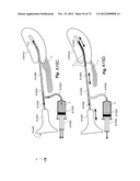 METHOD AND APPARATUS FOR HYSTEROSCOPY AND ENDOMETRIAL BIOPSY diagram and image