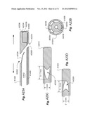 METHOD AND APPARATUS FOR HYSTEROSCOPY AND ENDOMETRIAL BIOPSY diagram and image