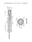 METHOD AND APPARATUS FOR HYSTEROSCOPY AND ENDOMETRIAL BIOPSY diagram and image