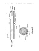 METHOD AND APPARATUS FOR HYSTEROSCOPY AND ENDOMETRIAL BIOPSY diagram and image