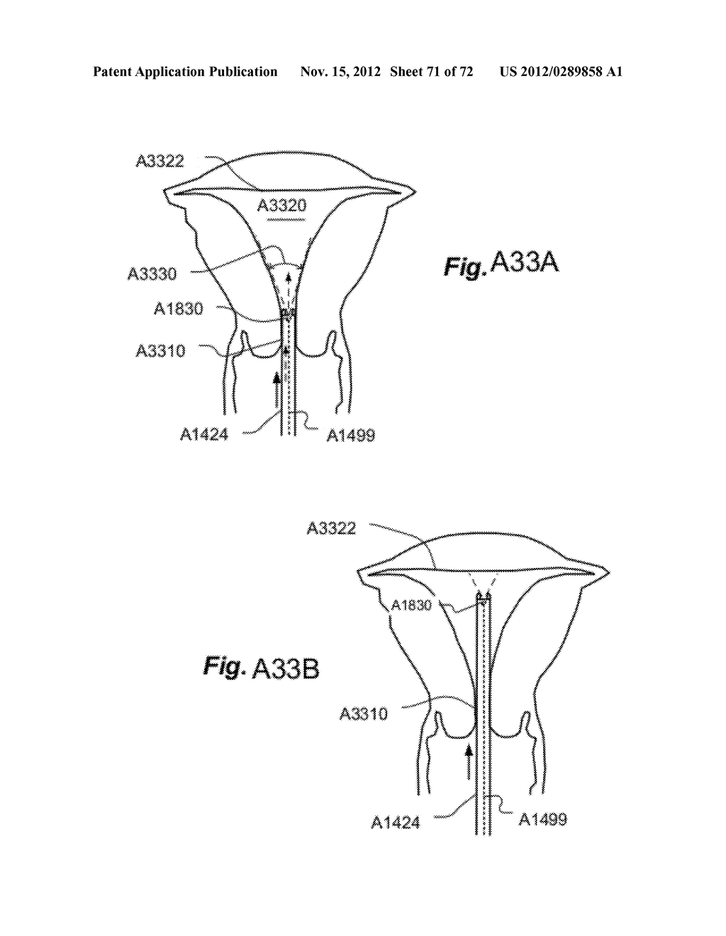 METHOD AND APPARATUS FOR HYSTEROSCOPY AND ENDOMETRIAL BIOPSY - diagram, schematic, and image 72