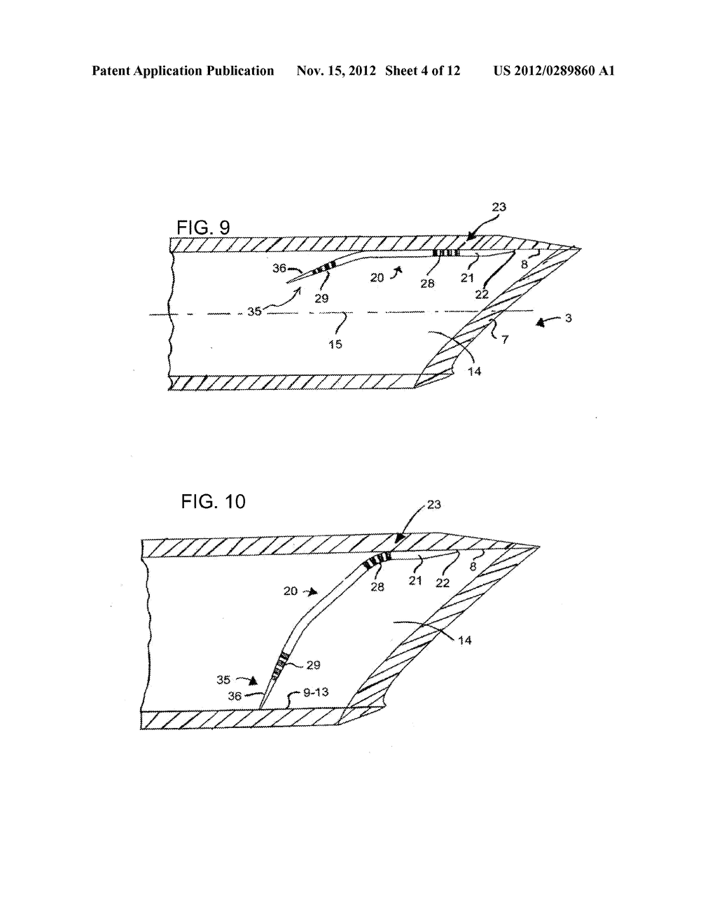 BIOPSY NEEDLE SYSTEM FOR OBTAINING A TISSUE BIOPSY SPECIMEN - diagram, schematic, and image 05