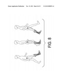 PORTABLE ACTIVE PNEUMATICALLY POWERED ANKLE-FOOT ORTHOSIS diagram and image