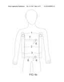 Spinal Posture Brace diagram and image