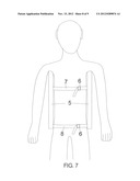 Spinal Posture Brace diagram and image