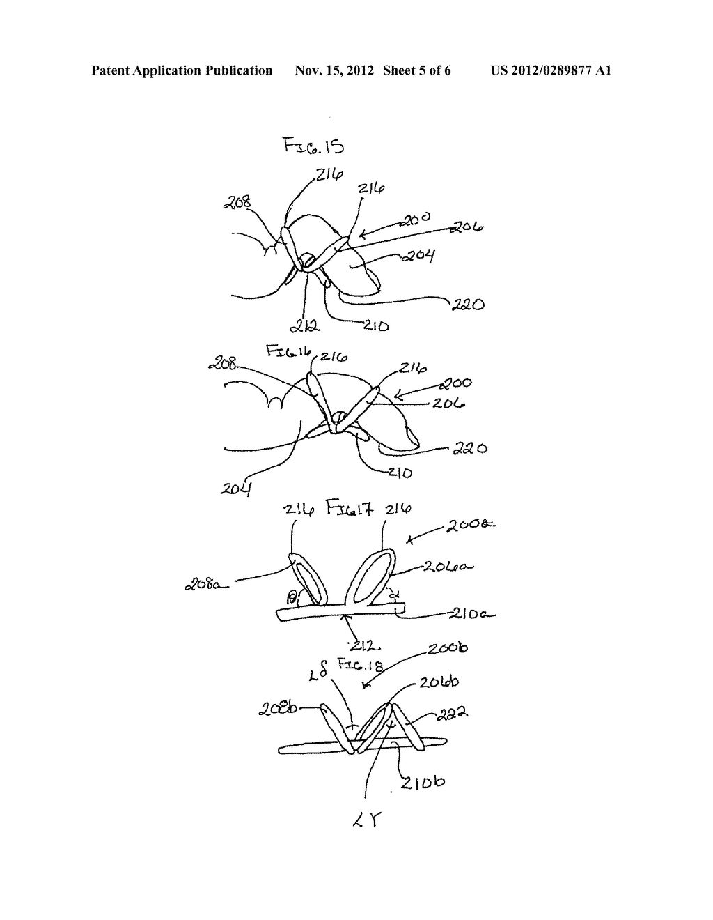 Phalangeal Deformity Ring Splint - diagram, schematic, and image 06