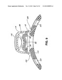 LOW PROFILE HIP ORTHOSIS diagram and image