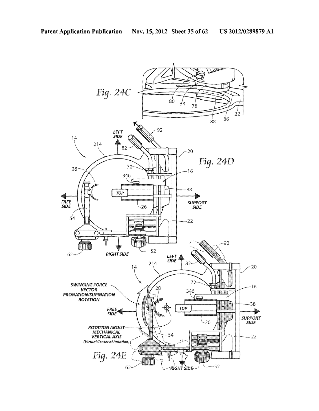 SYSTEMS, DEVICES, AND METHODS FOR MECHANICALLY REDUCING AND FIXING BONE     FRACTURES - diagram, schematic, and image 36