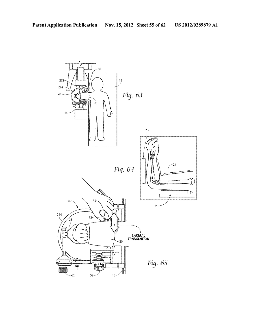 SYSTEMS, DEVICES, AND METHODS FOR MECHANICALLY REDUCING AND FIXING BONE     FRACTURES - diagram, schematic, and image 56