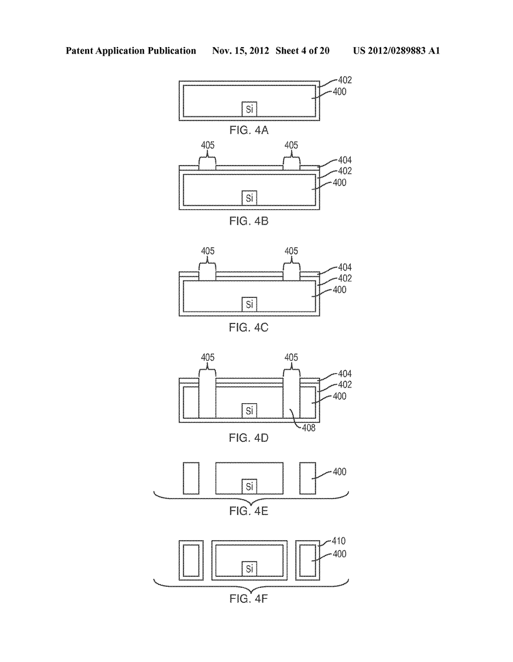 Implantable Intraocular Pressure Drain - diagram, schematic, and image 05