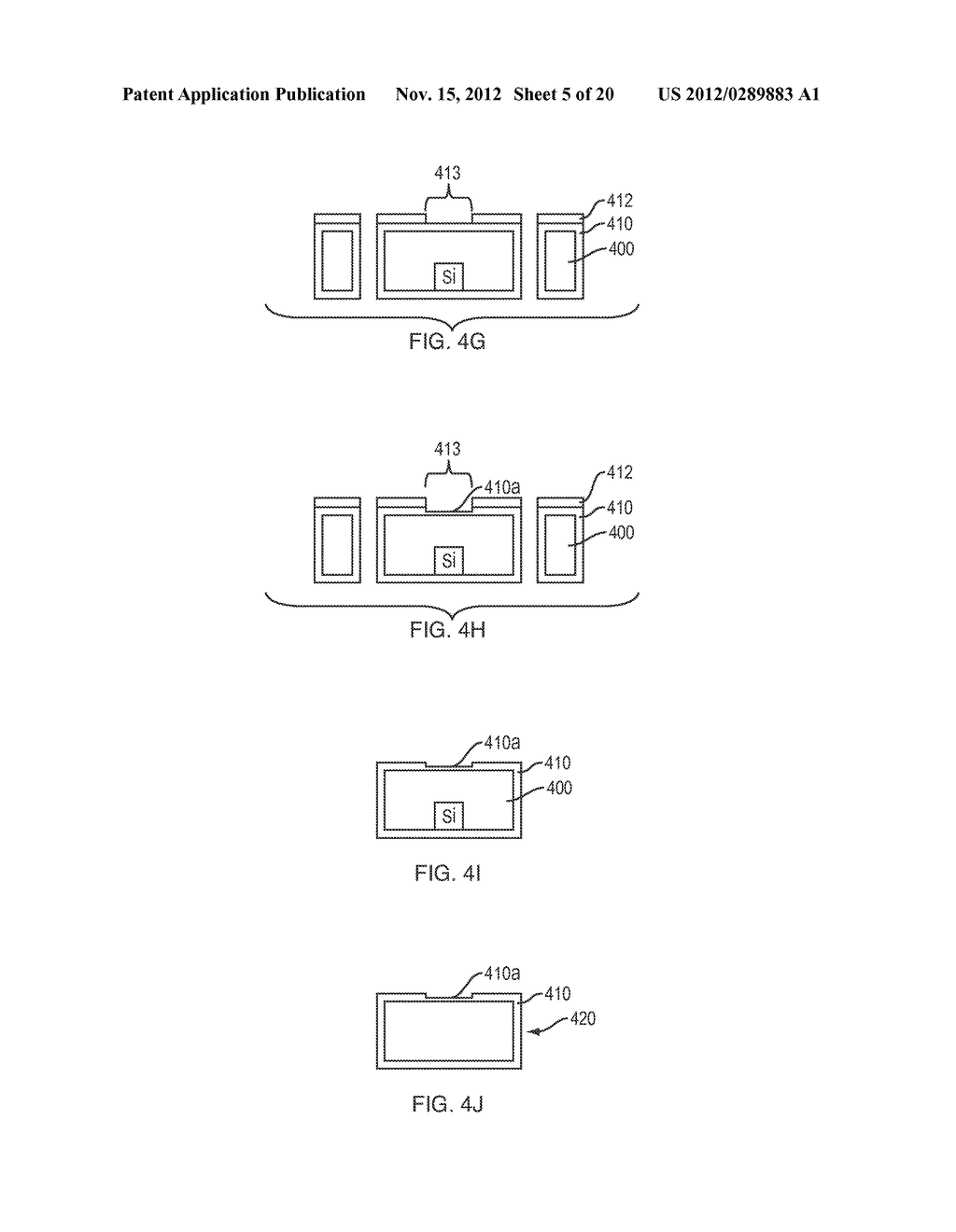 Implantable Intraocular Pressure Drain - diagram, schematic, and image 06